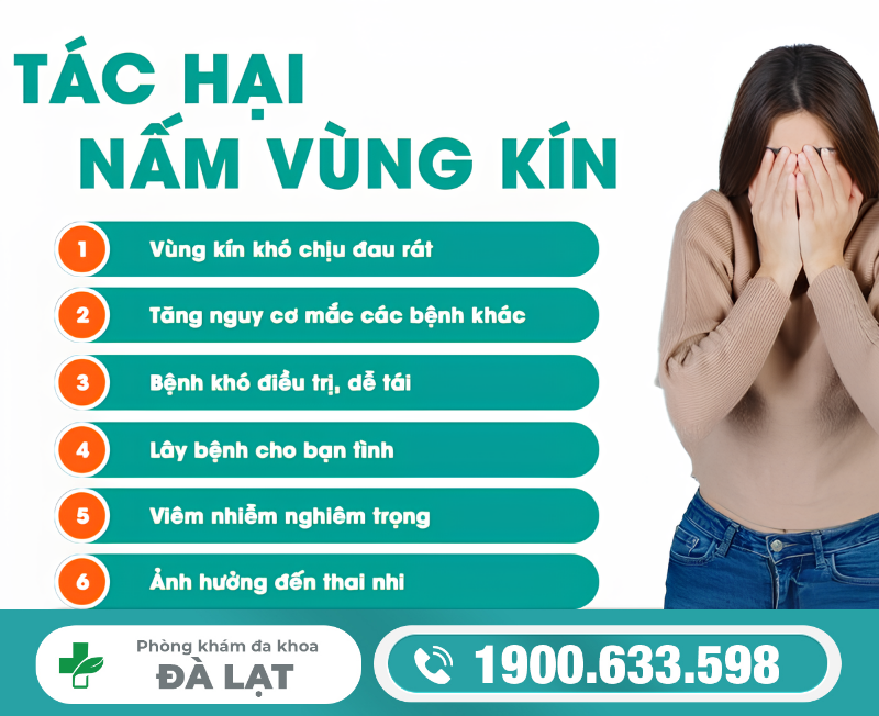 Hình ảnh minh họa